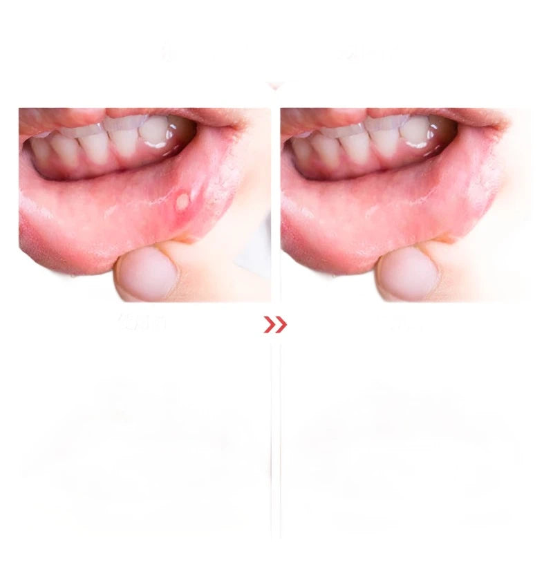 Red Light Therapy Wand by Rejuv™